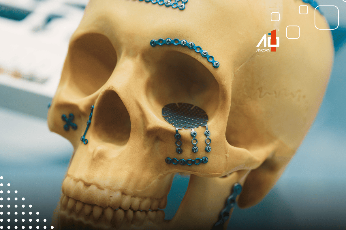 Descrição da imagem