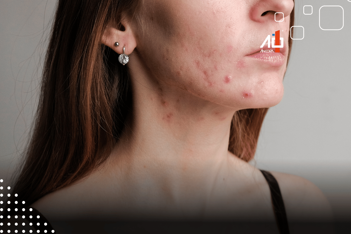 Descrição da imagem