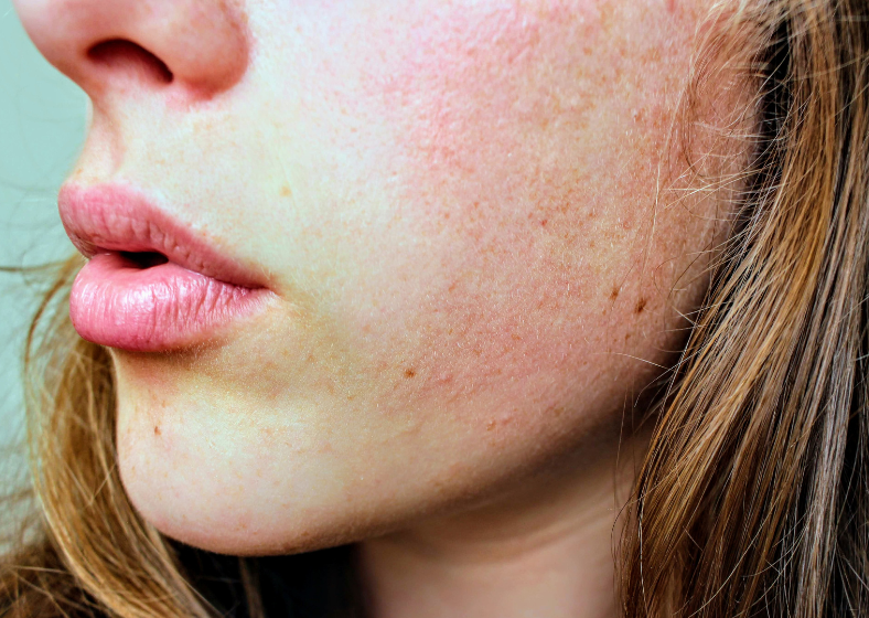 Descrição da imagem