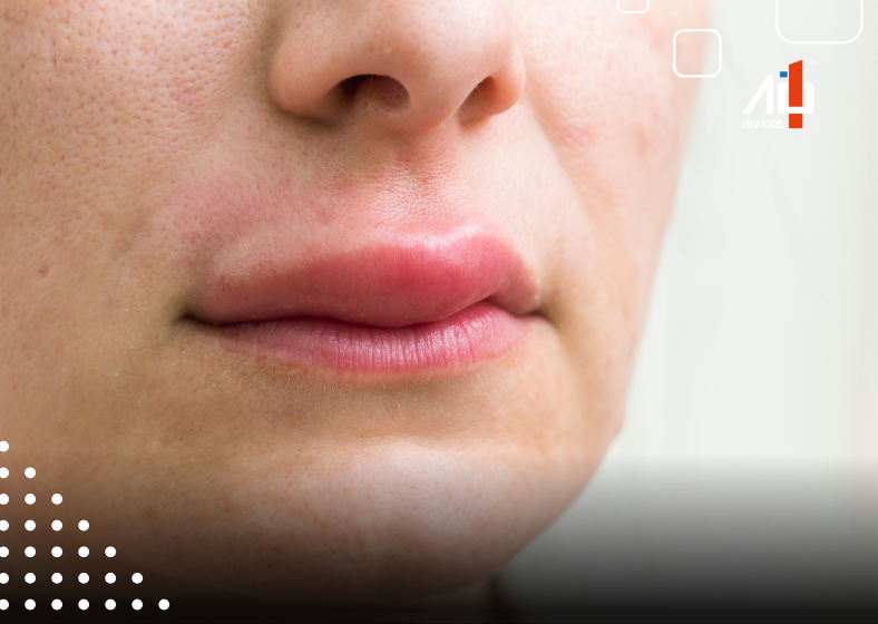 Descrição da imagem