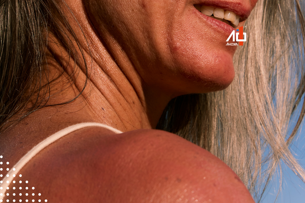 Descrição da imagem