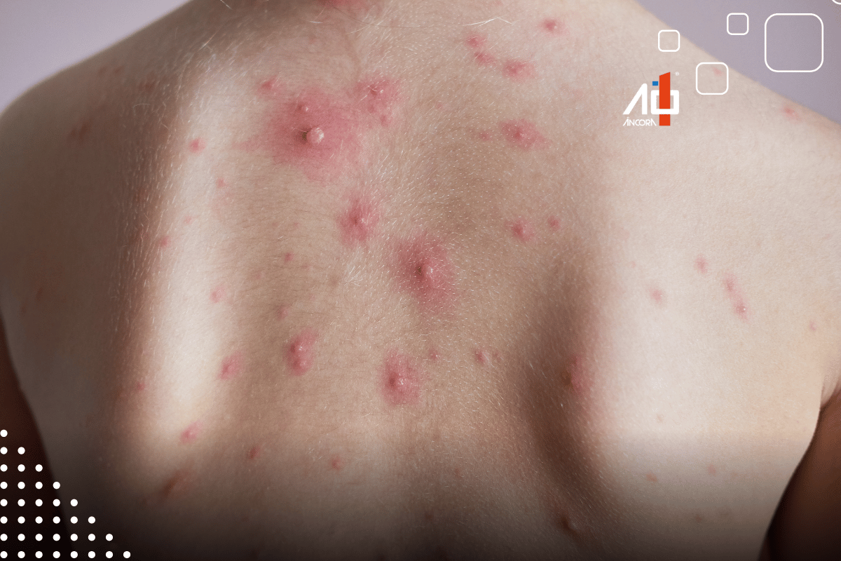 Descrição da imagem