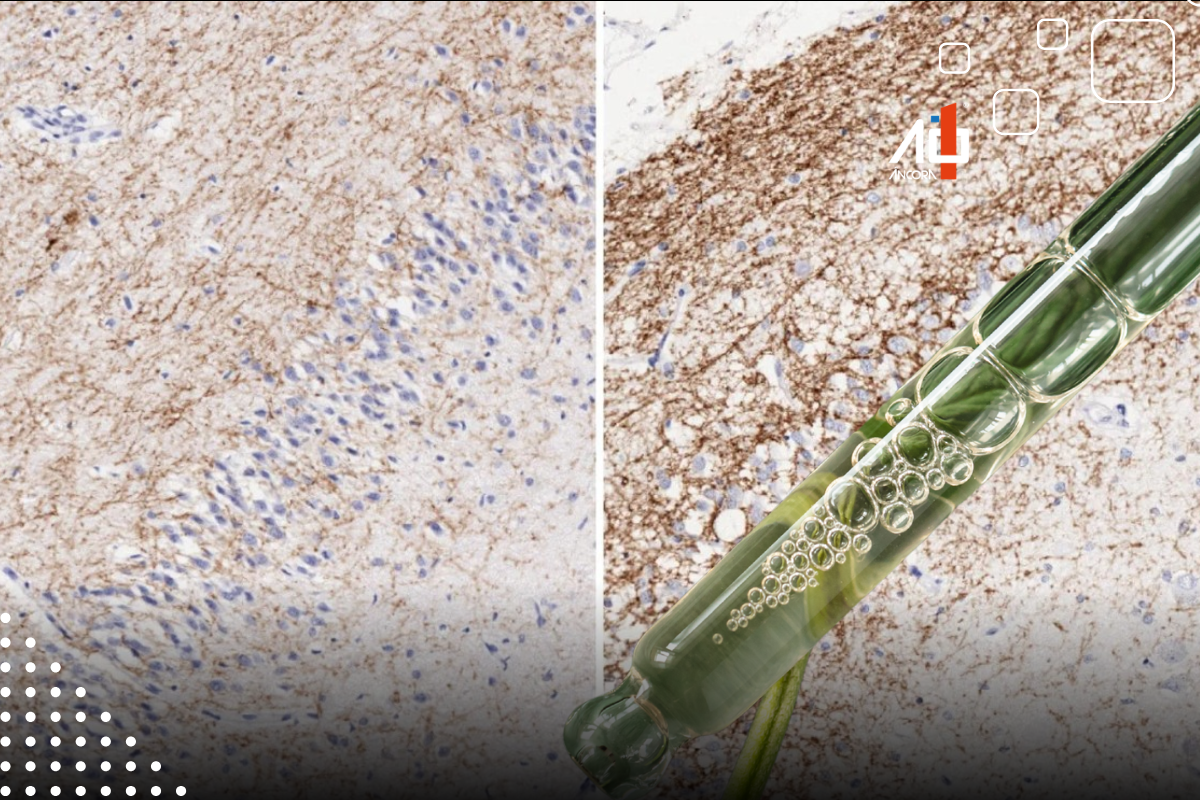 Descrição da imagem