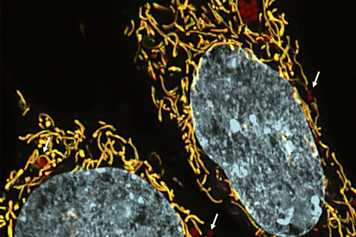 Descrição da imagem