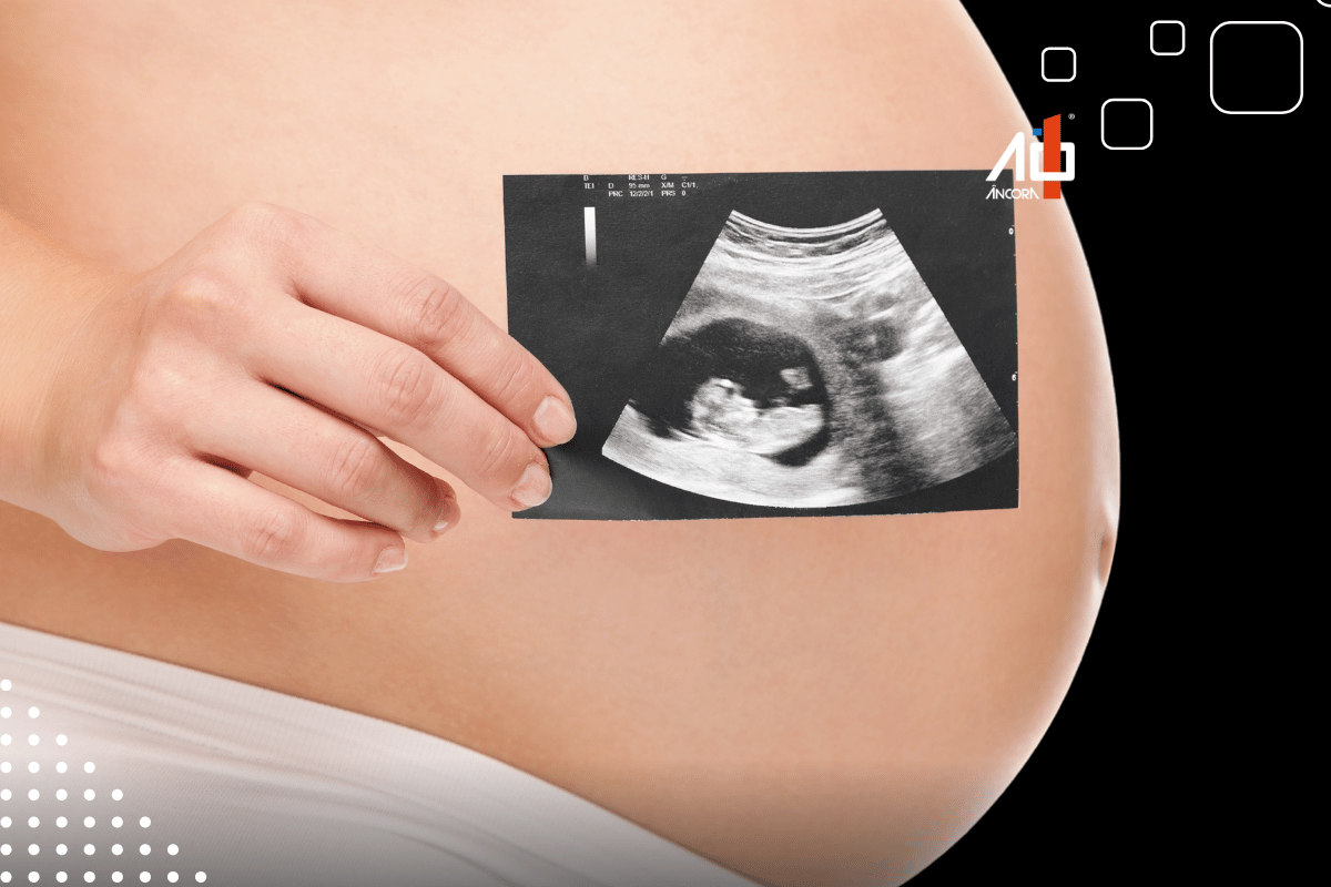 Descrição da imagem