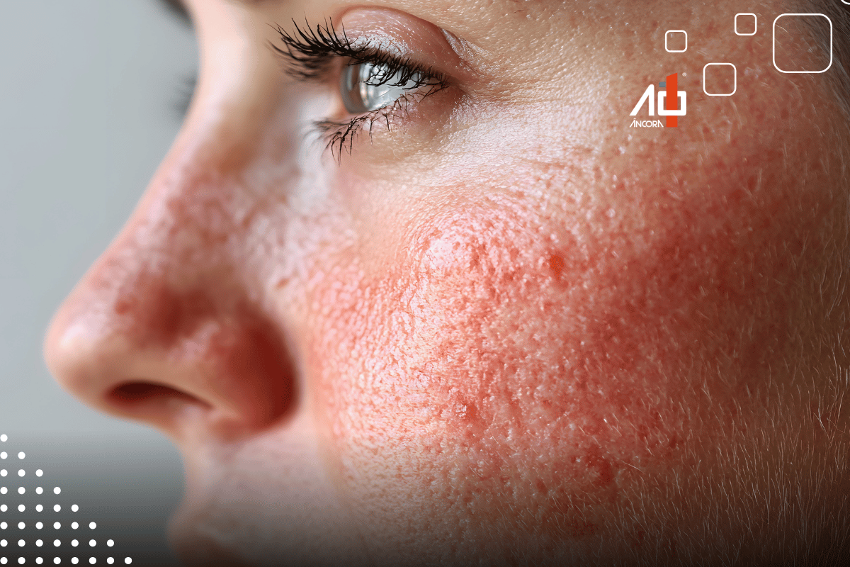 Descrição da imagem