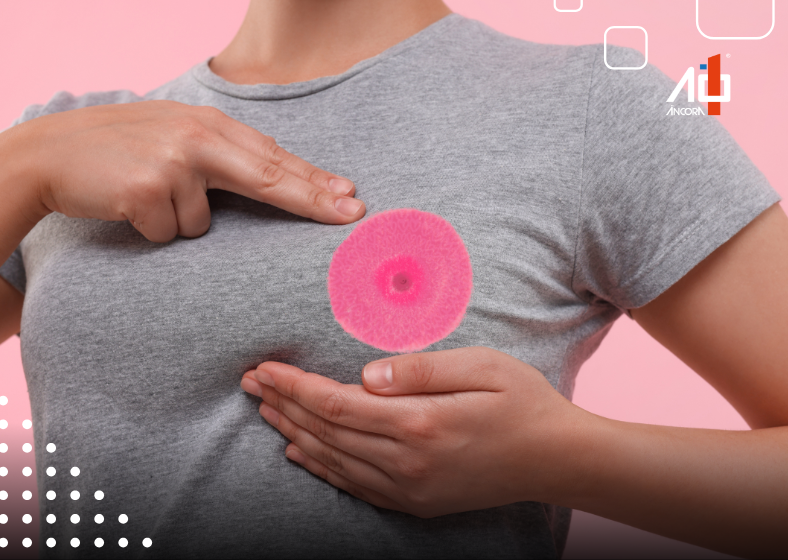 Descrição da imagem